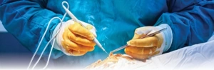 ELEKTROKOTER QƏLƏMLƏRİNİN SİRLƏRİNİ KƏŞF EDİN: MÜASİR CƏRRAHİYYƏDƏ DƏQİQLİK VƏ TƏHLÜKƏSİZLİK İNQİLABI