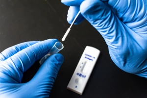 Ekspres Testlər: Sürətli Diaqnostikanın Üstünlükləri