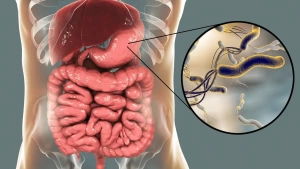 Mədə sağlamlığı üçün Helicobacter pylori testi: Qastrit səbəblərini erkən aşkarlamaq, Helicobacter pylori diaqnostikası, gizli təhlükələr
