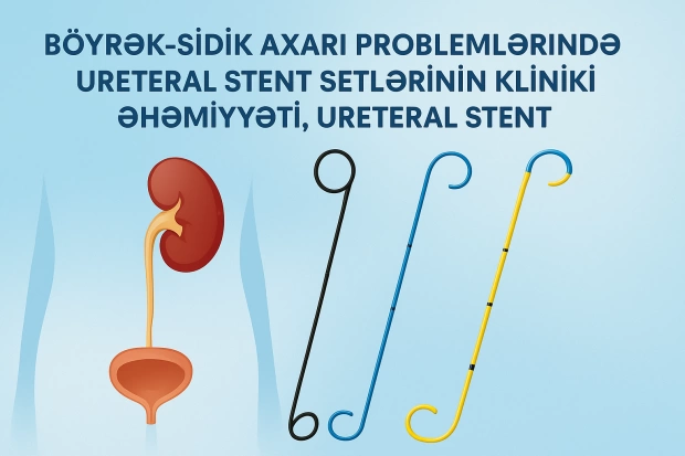 Böyrək–Sidik Axarı Problemlərində Ureteral Stent Setlərinin Kliniki Əhəmiyyəti, Ureteral Stentlərin İş Prinsipi və Tətbiqi